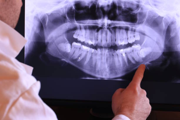 Best Broken or Chipped Tooth Repair in Collinsville, OK