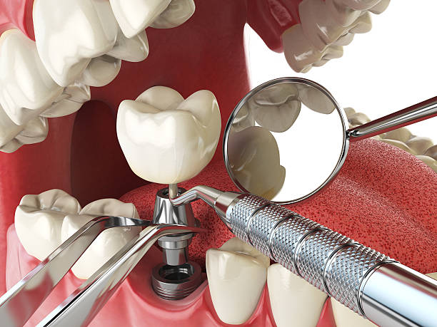 Best Dental Abscess Treatment in Collinsville, OK
